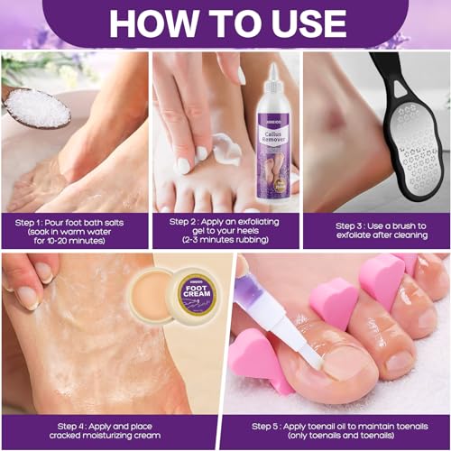 foot salt set Foot Soak with Epsom Salt - For Toenail Repair, Athletes Foot, Softens Calluses, Soothes Sore & Tired Feet¡¦