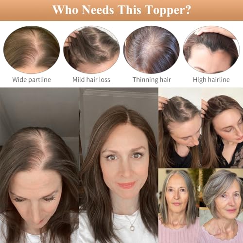Hair Toppers for Women Real Human Hair, Light Grey 14 Inch 360¡Æ Cover Middle Part Topper for Women with Thinning Hair Realistic Scalp Line 4x4.8 Inch Upgrade Basement HairPieces