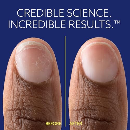 ePhD Bond Repair Nail Treatment, Nail Repair that Strengthens, Restores & Rebuilds Brittle Nails, Strengthens from Within, Formula for Damaged, or Post-Gel Nails, Use Alone or as a Polish Base