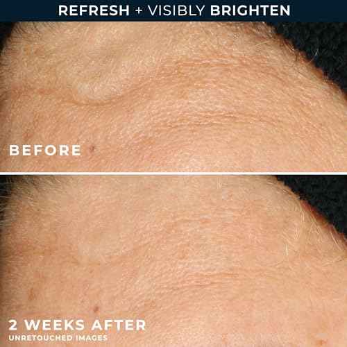 RoC Multi Correxion Revive + Glow Gel Vitamin C Cleanser, Face Wash, Facial Cleanser with Glycolic Acid, Paraben-Free, Sulfate-Free Skin Care - 6 Ounces