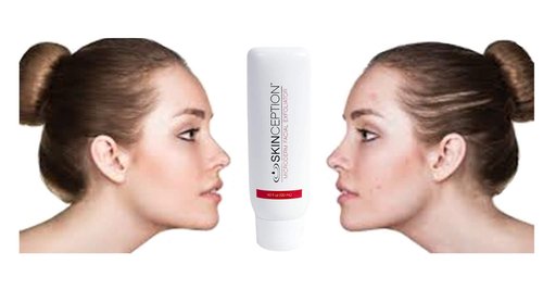 Skinception Microderm Facial Exfoliator (4 fl oz) 2 Pack to Encourage Healthy Exfoliation