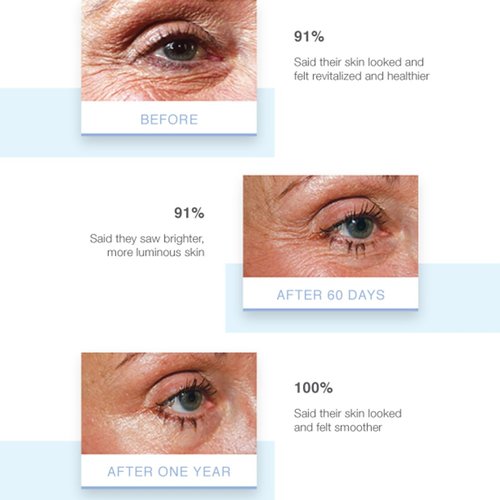 Stemulation Elevate Eye Creme - With Age Defying Growth Factors Formulated To Address The Appearance Of Fine Lines And Wrinkles