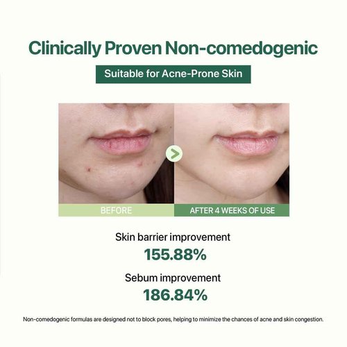 Le Nubele Azulene CICA Skin Toner for Clear Skin, Azulene 600ppm, Centella Asiatica 5000ppm, Hydrating, Non-Comedogenic, Calming, Redness Relief, Fungal Acne Safe, Korean Skin Care, 120ml/4.05 fl.oz.
