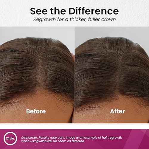 C'rcle Minoxidil for Women 5% Foam - Helps Restore Top of Scalp Hair Loss and Support Hair Growth for Women, Regrowth with Unscented Topical Treatment for Thinning Hair (5% Foam 8-Month Supply)