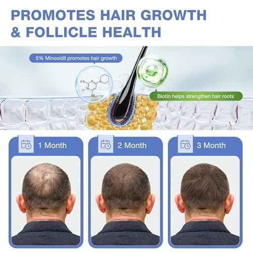 5% Minoxidil for Men, for Men & Women Hair with Biotin, Minoxidil for Beard Growth for Hair Loss to Hair Regrowth Get Thicker Fuller, Hair Loss Treatments for Women 100ml