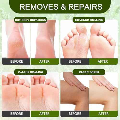Foot Callus Remover Gel Kit Heel Exfoliator Dead Skin Remover Pedicure Foot Spa Products Set Home Pedicure Foot Care Spa Supplies for Rough, Dry, Cracked Skin Cracked Heel, Professional