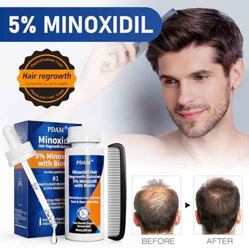 5% Minoxidil for Men Hair & Beard Growth Kit, Minoxidil for Women Hair Growth Serum, Extra Strength Hair Loss Treatment for Thinning Hair, Promotes Thicker Fuller Regrowth, Nourishes Scalp, 3 ¡¿ 2oz