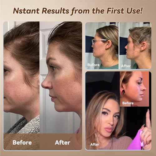 JUSRON V-Line Mask Chin Up Mask Face Strap, Soft Silicone Chin Strap V Shaped Face Mask 23-27 Inches (Pink)