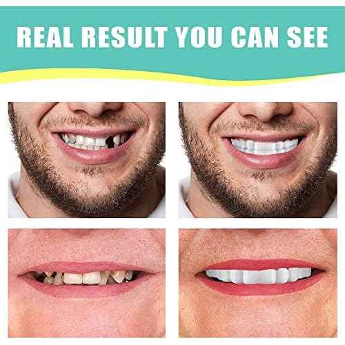 1Set Dentures Veneers Tooth,Dental Care Kits for Anti Molar Orthodontic Cosmetic Teeth,Smile Snap Tooth.(White,1Top+ 1Bottom+2Adhesives+1Tweezers+1Heart-Shaped Storage Box£©