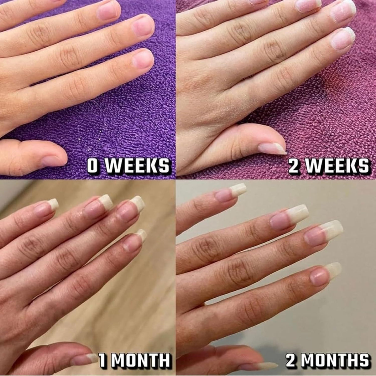 Nail Growth Oil - Enhance Strength & Moisture