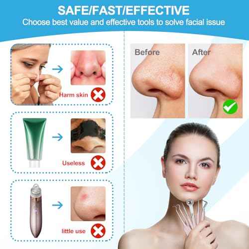 Pimple Popper Tool Kit Blackhead Remover Tools (5 Piece Kit), Professional Stainless Black Head Remover for face, Risk Free Treatment Pimple Extractor with Tweezers