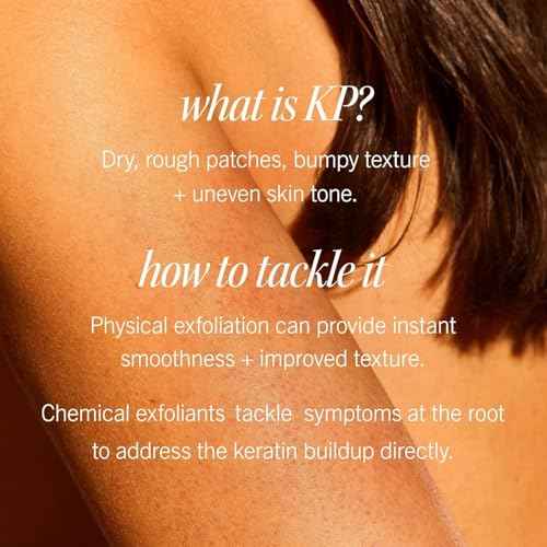 First Aid Beauty - KP Bump Eraser Body Scrub with 10% AHA, Keratosis Pilaris Skin Exfoliater with Glycolic and Lactic acids, Helps Reduce Chicken Skin Bumps, Safe for Sensitive Skin, 10 oz