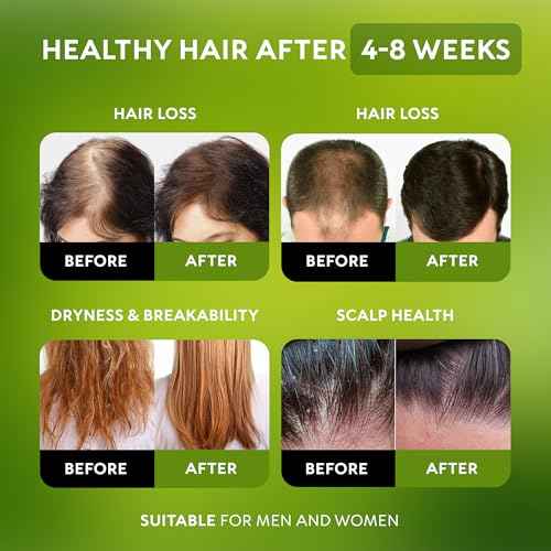 Batana Oil for Hair Growth - 100% Raw & Organic Dr Sebi Batana Oil - Cold-Pressed & Pure Unrefined Batana Hair Mask for Women & Men - Enhances Hair Thickness, Prevents Loss, Repairs Split Ends
