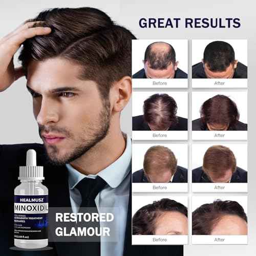 5% Minoxidil for Men & Women, Biotin, Unscented, Red, Unisex-Adults, Hair Growth, Hair Fall Control, 2 Bottles, 100ml (3.36 Fl Oz)