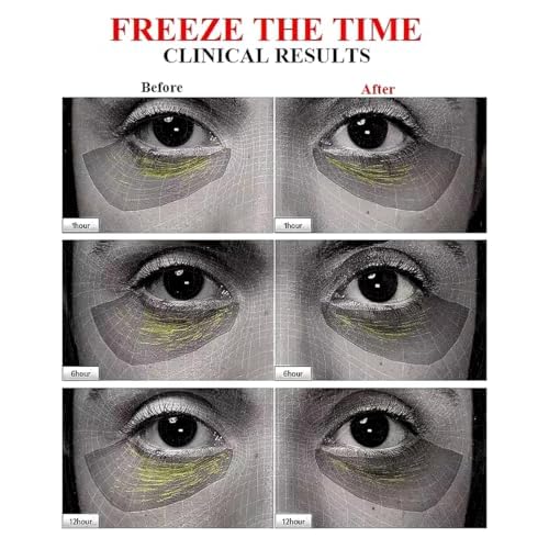 (85%) Human Stem Cell & (10%) PDRN Anti-Aging & Repair Ampoule Serum (12 Vials, 120ml) for Youthful, Radiant Skin!