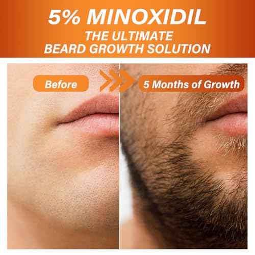 5% Minoxidil Beard Growth Serum for Men, 5% Minoxidil Hair Regrowth Roller Bottle Design, Extra Strength Beard Growth Oil for Stronger Thicker Fuller Beard Faster