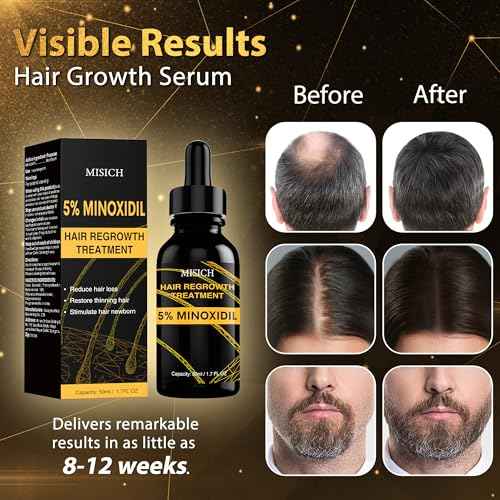5% Minoxidil for Men and Women, Biotin Hair Growth Serum Oil, Natural Hair Loss Regrowth Treatment for Thicker, Fuller Hair 50ml