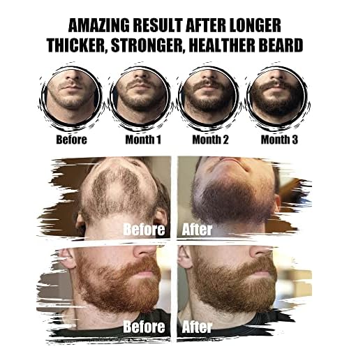 Beard Kit for Men Grooming & Care: with 2 Pack Beard Oils and Balm - Wash & Conditioner for After Shave Lotions Sandalwood, Brush and Comb Sets with Scissors, Valentines Fathers Gifts for Dad/Men/Him