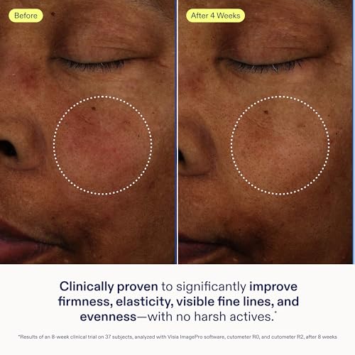 Skinfix Exo + Ectoin Intensive Repair Baume - 1 oz - Retinol-Free Face Serum with Hyaluronic Acid, Peptides - Visibly Smooths Wrinkles, Evens Dark Spots & Redness - Fragrance Free, Vegan, Cruelty Free