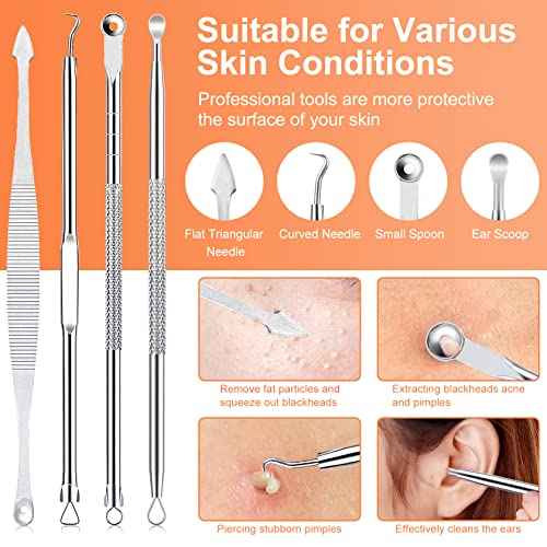 Pimple Popper Tool Kit, IUMAKEVP 15 PCS Professional Stainless Steel Blackhead Remover Comedone Extractor Tools for Removing Zit on Face - Acne Removal Kit with Metal Case (Silver)