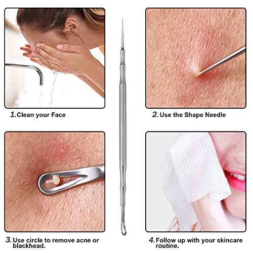 Pointed Blackhead Removal, 2-in-1 Acne Extractor Tool - Stainless Steel Whitehead Remover for Face/Nose