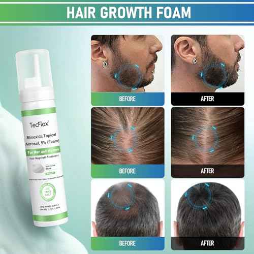 Minoxidil Foam - 5% Minoxidil for Men and Women, Hair and Beard Growth with Biotin, Thicker Hair, Unscented, 3 x 2.11 Oz, 3-Month Supply, Hair Loss Treatment,Green