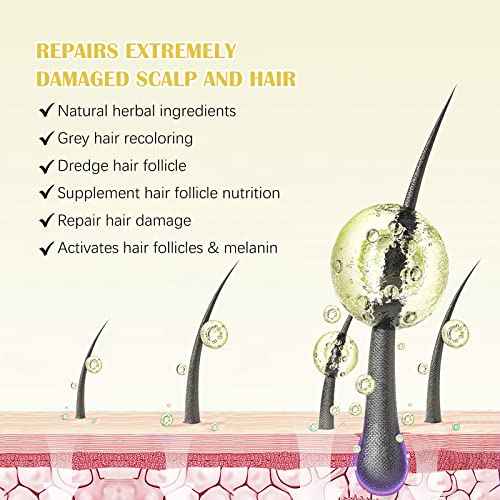 2 Pack 5% Minoxidil Hair Growth Serum,Minoxidil For Men and Women Hair,2.02 oz Biotin Hair Regrowth Serum Treatment For Getting Thicker Healthier Hair