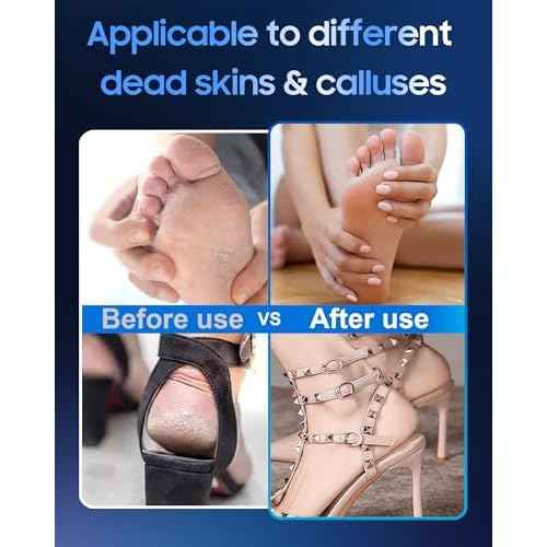 11000 RPM Rechargeable Electric Foot Callus Remover with 2Glass Sander Discs - Cordless Foot Scrubber,Professional Pedicure Tool for Dead Skin and Calluses,Electric Foot File - Blue