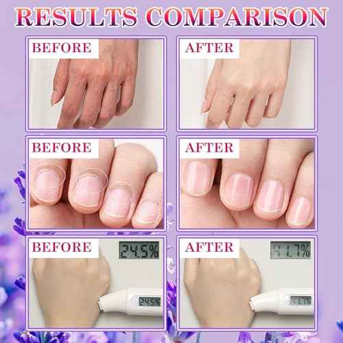 6 Pairs Hand Masks Moisturizing Gloves, Hydrating Hand Mask Moisturizer Gloves Care for Dry Cracked Hands, Smooth Long Lasting Soft Firming Hand Mask Gift Set for Men Women£¨A