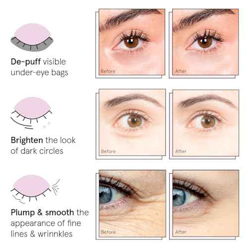 grace & stella Under Eye Patches (12 pairs) Eye Masks for Dark Circles and Puffiness - Stocking Stuffers for Women, Christmas Gifts, Birthday Gifts, Bachelorette Party Favors, Bridesmaid Proposal Gift