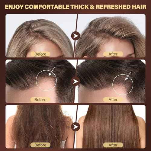 Scalp Scrub, 2-in-1 Scalp Exfoliator Clarifying Shampoo for Dandruff, Dry & Itchy Scalp Care, Batana Oil & Rosemary Scrub Scalp Treatment with Scalp Massager Promotes Hair Growth, 10.93 oz