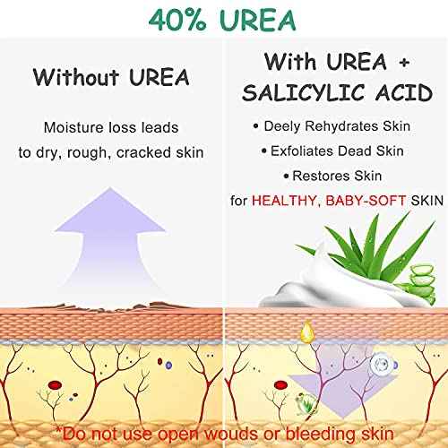 Urea Cream 40 Percent For Feet, Foot Cream, 40% Urea Lotion For Dry Skin/Cracked Heels/Ultra Calloused Feet, Softening Rough Skin On Feet, Skin Care with Glycerin, Jojoba for Men/Women, 4.3 oz