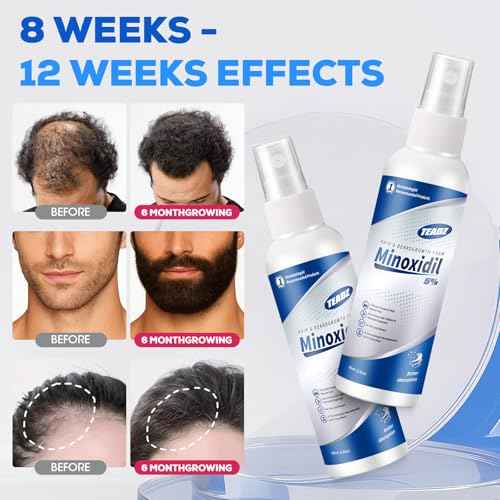 5% Minoxidil for Men and Women£¬Minoxidil hair growth products£¬Intense Hair Growth Serum£¬May Promote Faster, Stronger, Thicker Hair Growth to Fight Hair Loss and Thinning Hair£¨2.82 oz*2£©