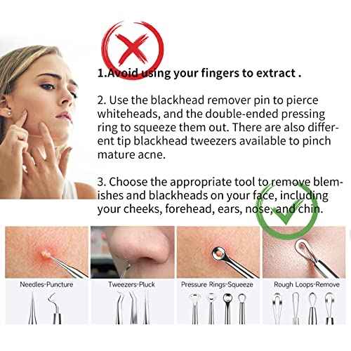 2025 Professional Pimple Popper Tool Kit - 22 PCS Blackhead Remover Tools for Acne and Zit Popping Comedone Extractor with Magnifying Glass