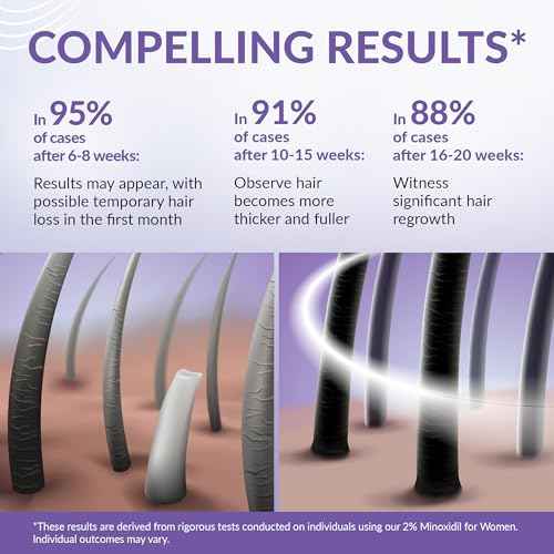 Minoxidil for Women 2% - Hair Growth Serum Women + Vitamin E, Ginseng, Ginger Extract, Biotin Hair Growth Serum - Hair Loss Regrowth & Thickening Treatment Helper