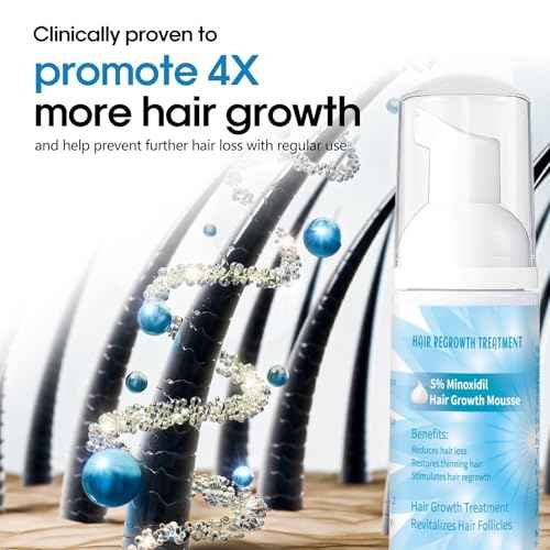 5% Minoxidil Foam for Men, Minoxidil for Women Hair Growth, Infused with Biotin, Hair Growth Treatment, Foam Hair Regrowth Treatment for Hair Thinning Receding Hairline,(2 oz Bottle), 3-Pack