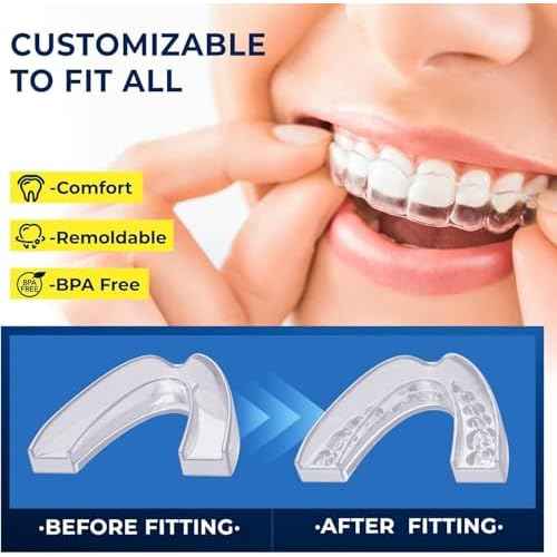 Mouth Guard for Grinding Teeth at Night: Mouth Guard for Sleeping - Night Guard for Teeth Grinding (Two Sizes /4 Packs)