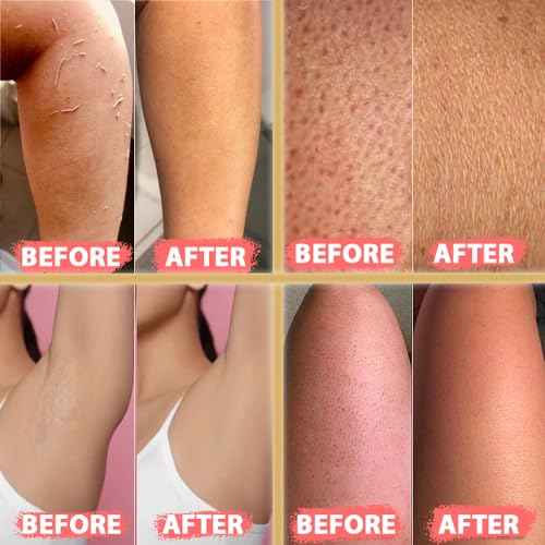 Kelebek Premium Natural Exfoliating Gloves, Turkish Hammam Kese, Original Exfoliating Mitt, Body Scrub for Men and Women