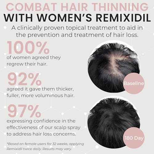 2% Minoxidil for Women Hair Regrowth Spray? Minoxidil Thicker & Fuller Topical Solution for Hair Loss Treatment, Follicle Reactivation, Clinically Proven Formula - 60 ml