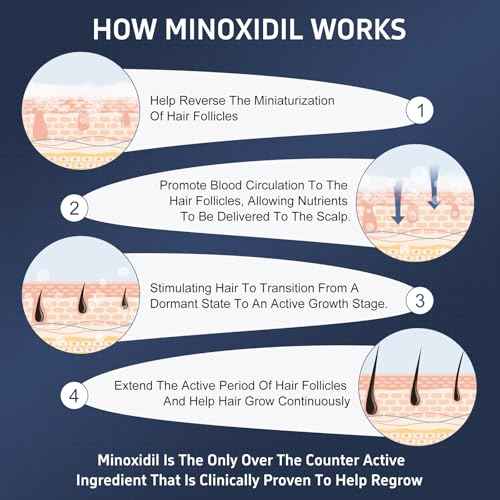 4 Packs Minoxidil Foam, 5% Minoxidil for Men and Women, Infused with Biotin, Hair Growth Treatment, Supports Thicker and Fuller Hair & Beard, Upgraded version (Minoxidil Foam 8.44Oz, 4-Month Supply)
