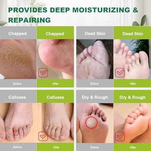 300PCS Disposable Foot Covers for Feet Moisturizer Socks - Plastic Foot Covers Extra Large Size for Pedicure, Moisturizing & Paraffin Wax Treatments, Spa Socks Designed for Foot Care