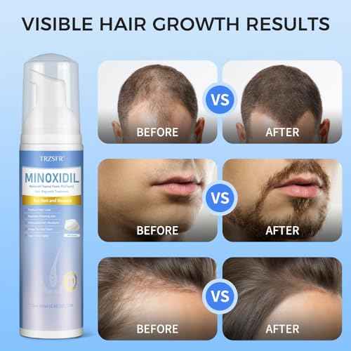 5% Minoxidil Foam for Men & Women, Hair Regrowth Treatment for Thinning Hair & Beard Growth, Extra Strength Topical Foam, Clinically Proven Hair Loss Treatment, 6 Month Supply (14OZ Total)