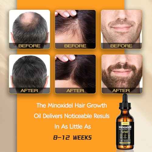 5% Minoxidil Hair Growth Oil for Men & Women - Extra Strength Regrowth Serum, Topical Hair Loss Treatment Serum, Thicker, Healthier Hair & Beard Growth Kit, 2.11 fl.oz