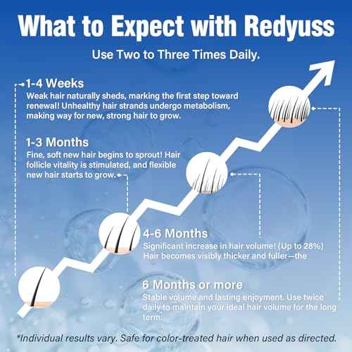 5% Minoxidil for Men and Women Hair Growth Spray Serum Minoxidil Biotin for Hair Beard Growth Prevent Hair Loss for Thicker Longer Fuller Healthier Hair 3 Bottles of 2oz