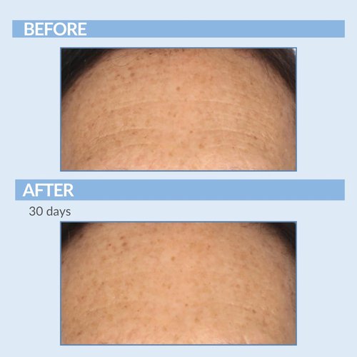 Retinol Anti-Aging Skin Care Set - Serum, Facial Moisture Cream & Face Wash - Smooth Fine Lines, Deep Wrinkles and Minimize Pores - Serious Skincare - 3 Piece Kit