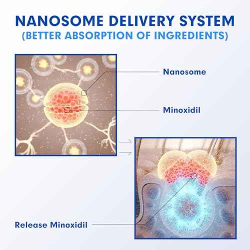 5% Minoxidil for Men, Extra Strength Hair Growth Serum, Beard Growth Oil, Fast Absorbing Dropper, Non Greasy, Low Residue Formula, 2-Pack for 2 Months, Hair Regrowth Treatment for Thinning Hair