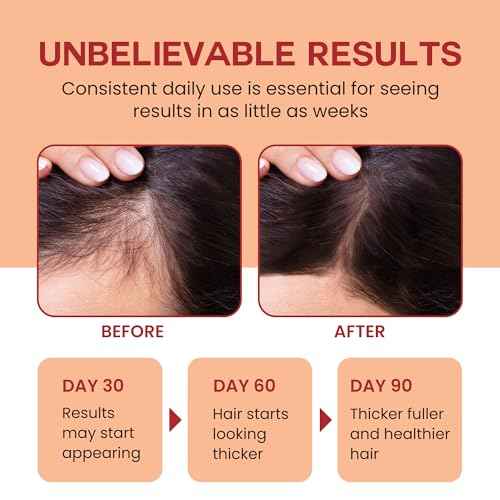 Raw Batana Oil for Hair Growth - 100% Pure, Organic 4oz Batana from Honduras for Thick and Strong Natural Hair - Dr. Sebi Unrefined Cold Pressed Cosmetic Scalp Mask Gifts for Women (1 Pack)
