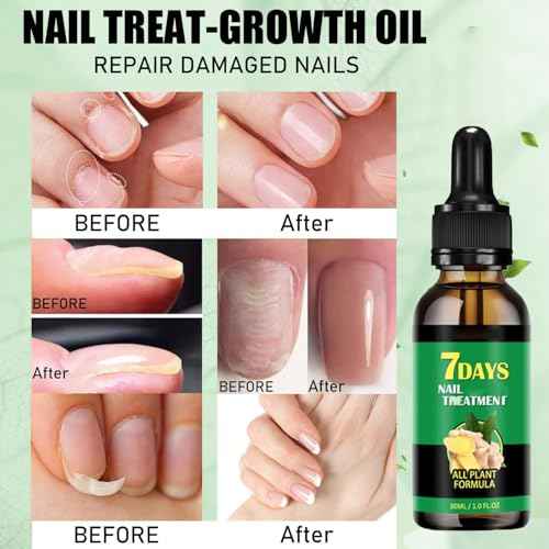 Ginger Nail Treatment Nail Support Nail Care, Nail Treatment, Ginger Nail Growth Serum, Ginger Cuticle Care Oil for Nails,Cuticle Serum for Nails