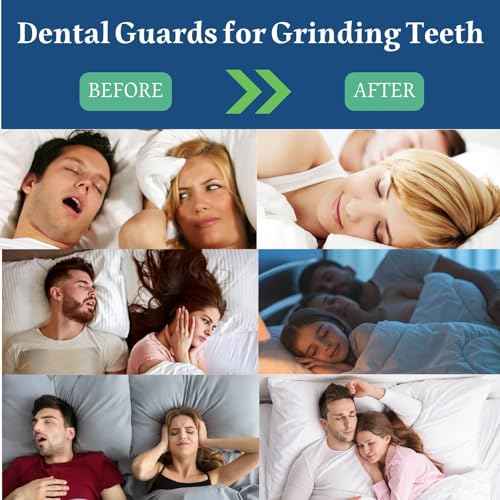 Mouth Guard for Clenching Teeth at Night, 4 Pcs Night Guards for Teeth Grinding, Professional Dental Guards for Grinding Teeth, Moldable Mouthguards for Grinding of Teeth, Teeth Grinding Guard