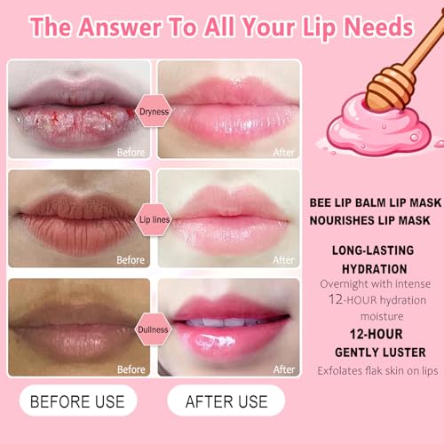 9 PCS Bee Lip Balm Honey Pot, Strawberry, Watermelon, Coconut, Aloe, Cherry, Grape & Peach Flavors, Honey Lip Balm Bulk, Moisturizing Lip Mask Overnight for Dry Cracked Lips, Reduce Lip Lines